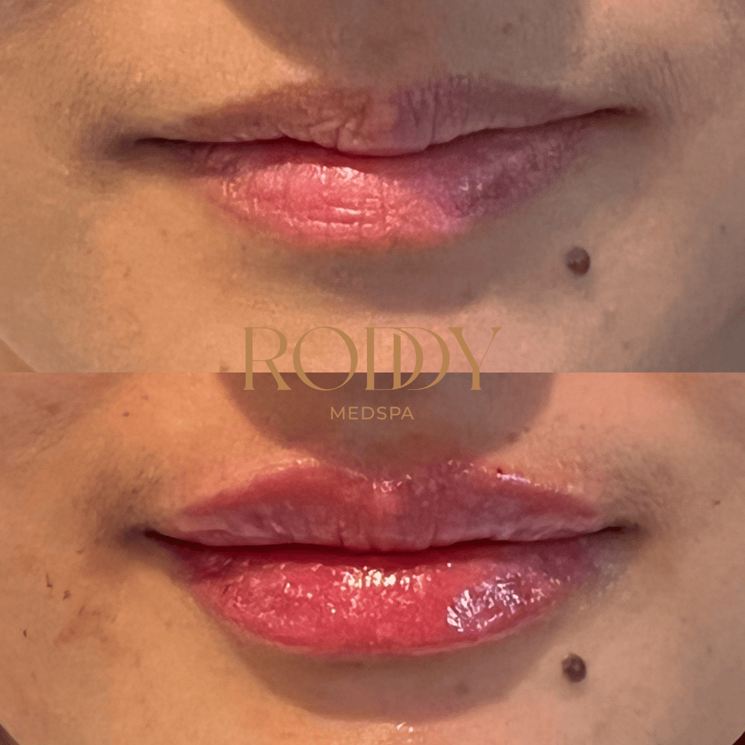 Before-After Photos