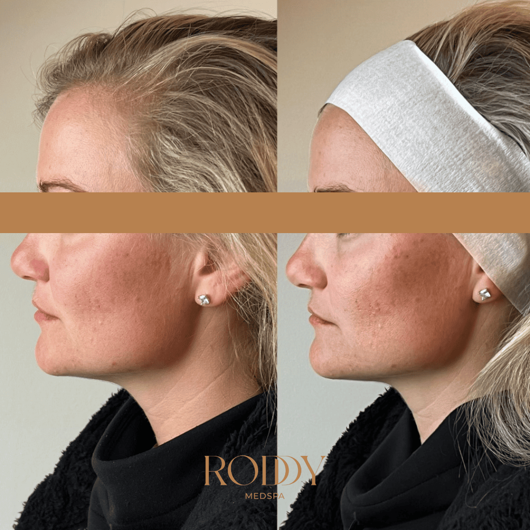 Before-After Photos